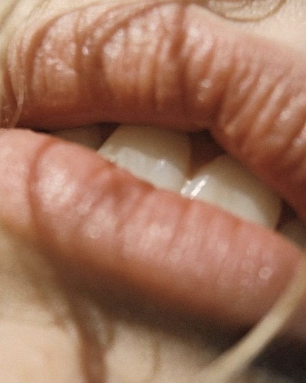 How to Achieve Your Beautiful Wedding Smile | Tips on Maintaining White Teeth Before Your Big Day