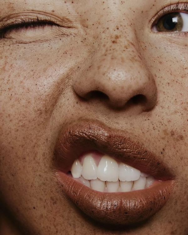 Bridal Teeth Whitening: How to Get a Camera-Ready Smile for Your Wedding