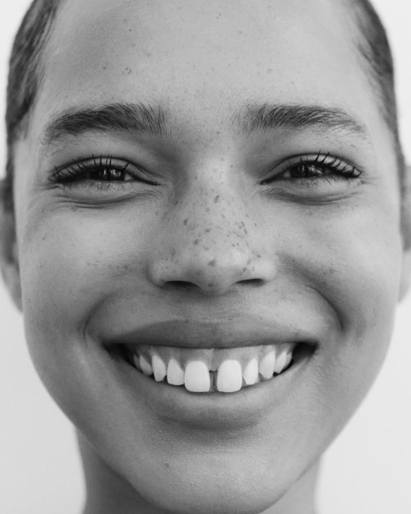 Bridal Teeth Whitening: How to Get a Camera-Ready Smile for Your Wedding